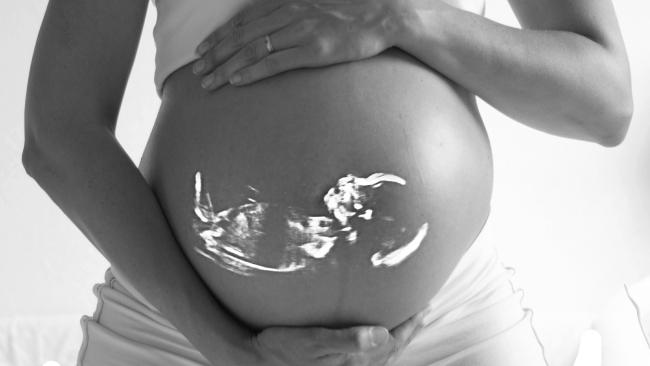 Image of A pregnant person holding their stomach, with an ultrasound scan of a baby superimposed onto it.