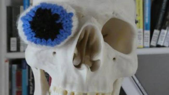Knitted eyeball in a teaching skeleton's eye socket